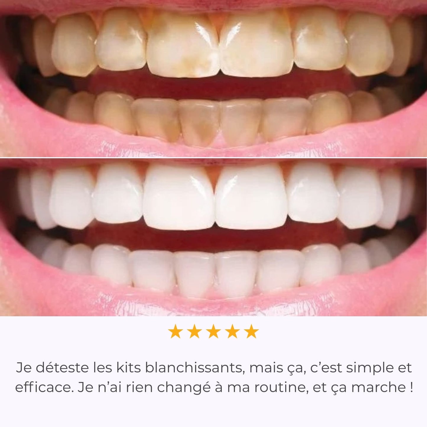 IVISMILE – Brosse à dents LED pour un sourire lumineux sans effort