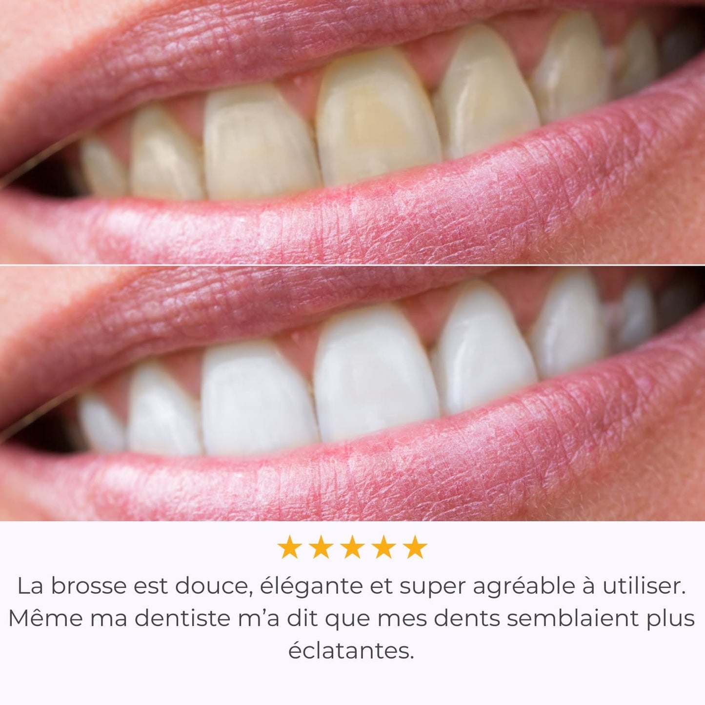 IVISMILE – Brosse à dents LED pour un sourire lumineux sans effort