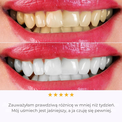 IVISMILE – Brosse à dents LED