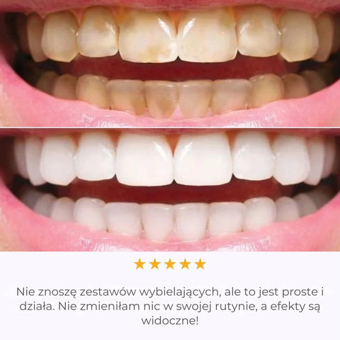 IVISMILE – Brosse à dents LED