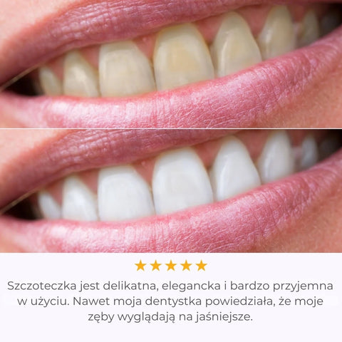 IVISMILE – Brosse à dents LED